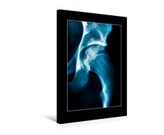 Calvendo Premium Textil-Leinwand 30 cm x 45 cm hoch, HÃ¼ftgelenk | Wandbild, Bild auf Keilrahmen, Fertigbild auf echter Leinwand, Leinwanddruck Menschen Menschen