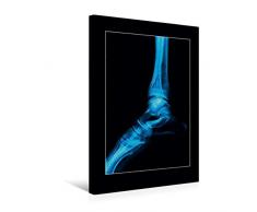 Calvendo Premium Textil-Leinwand 30 cm x 45 cm hoch, FuÃgelenk | Wandbild, Bild auf Keilrahmen, Fertigbild auf echter Leinwand, Leinwanddruck Menschen Menschen