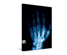 Premium Textil-Leinwand 50 x 75 cm Hoch-Format Röntgenbild von einem Handknochen. | Wandbild, HD-Bild auf Keilrahmen, Fertigbild auf hochwertigem Vlies, Leinwanddruck von Georg Hanf