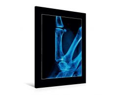 Calvendo Premium Textil-Leinwand 60 cm x 90 cm hoch, Finger | Wandbild, Bild auf Keilrahmen, Fertigbild auf echter Leinwand, Leinwanddruck Menschen Menschen