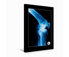 Calvendo Premium Textil-Leinwand 30 cm x 45 cm hoch Seitenansicht eines Kniegelenks | Wandbild, Bild auf Keilrahmen, Fertigbild auf echter Leinwand, Leinwanddruck Menschen Menschen