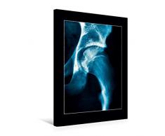 Calvendo Premium Textil-Leinwand 50 cm x 75 cm hoch, HÃ¼ftgelenk | Wandbild, Bild auf Keilrahmen, Fertigbild auf echter Leinwand, Leinwanddruck Menschen Menschen