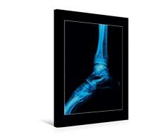 Calvendo Premium Textil-Leinwand 50 cm x 75 cm hoch, FuÃgelenk | Wandbild, Bild auf Keilrahmen, Fertigbild auf echter Leinwand, Leinwanddruck Menschen Menschen