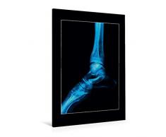 Calvendo Premium Textil-Leinwand 80 cm x 120 cm hoch, FuÃgelenk | Wandbild, Bild auf Keilrahmen, Fertigbild auf echter Leinwand, Leinwanddruck Menschen Menschen