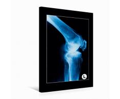 Calvendo Premium Textil-Leinwand 50 cm x 75 cm hoch Seitenansicht eines Kniegelenks | Wandbild, Bild auf Keilrahmen, Fertigbild auf echter Leinwand, Leinwanddruck Menschen Menschen