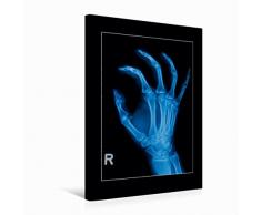 Calvendo Premium Textil-Leinwand 50 cm x 75 cm hoch Vorderansicht eines Kreuzbeins und des Beckens | Wandbild, Bild auf Keilrahmen, Fertigbild auf echter Leinwand, Leinwanddruck Menschen Menschen