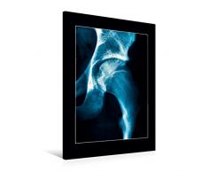 Calvendo Premium Textil-Leinwand 60 cm x 90 cm hoch, HÃ¼ftgelenk | Wandbild, Bild auf Keilrahmen, Fertigbild auf echter Leinwand, Leinwanddruck Menschen Menschen