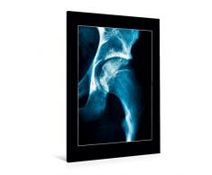 Calvendo Premium Textil-Leinwand 80 cm x 120 cm hoch, HÃ¼ftgelenk | Wandbild, Bild auf Keilrahmen, Fertigbild auf echter Leinwand, Leinwanddruck Menschen Menschen