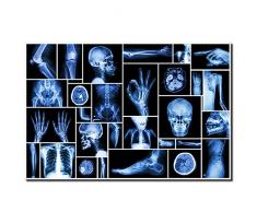 klvos schwarz und weiß Menschlicher Schädel Leinwand X-Ray Bild Poster Wall Art Prints Wandbild für Krankenhaus Orthopädische Chirurg Büro Wand Decor bereit hängen auf 61 x 91,4 cm Art Deco 24x36 schwarz und blau